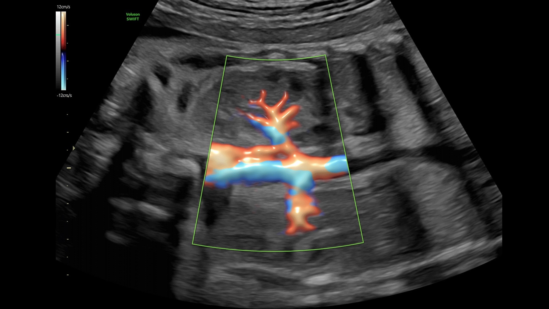 Product Media Carousel Image