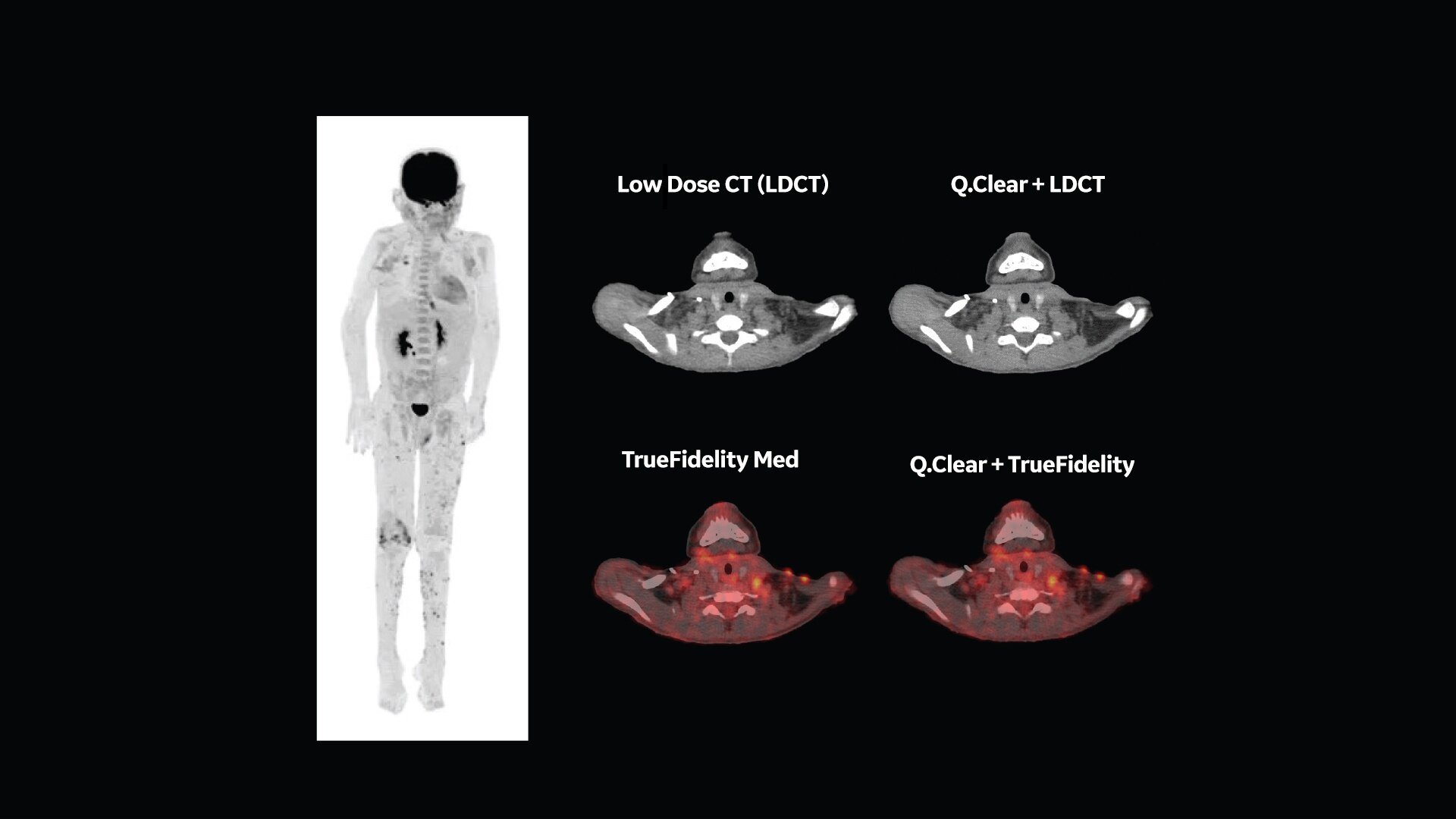 Product Media Carousel Image