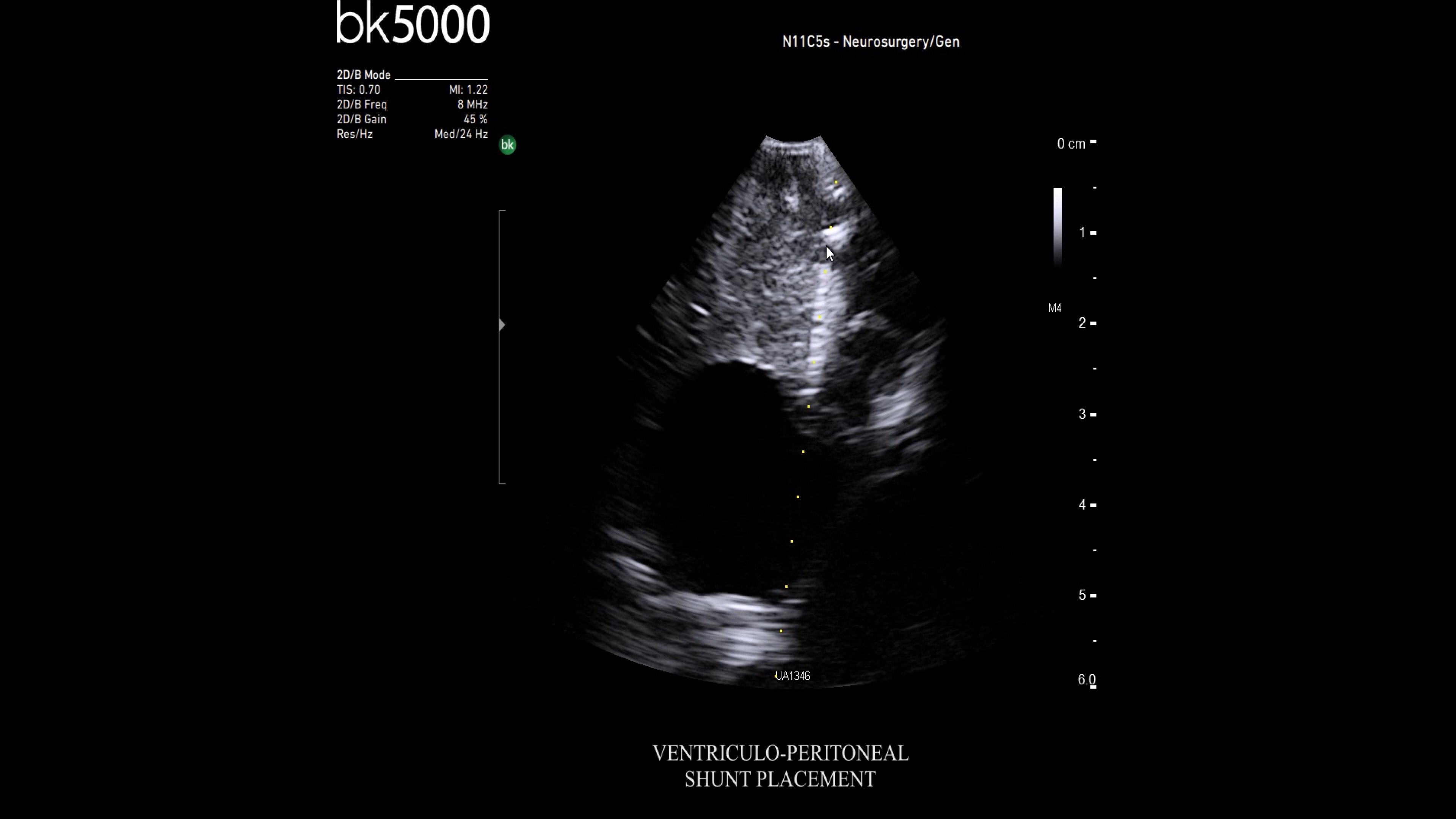 Product Media Carousel Image