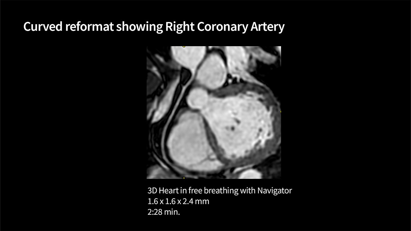 Product Media Carousel Image