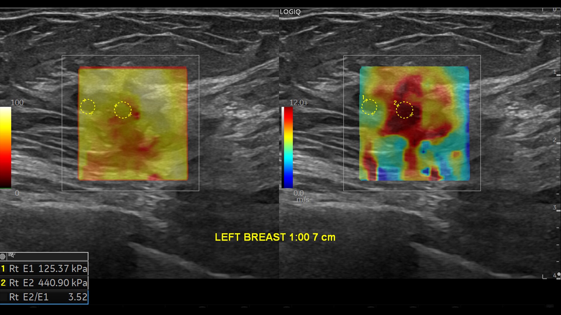 Product Media Carousel Image