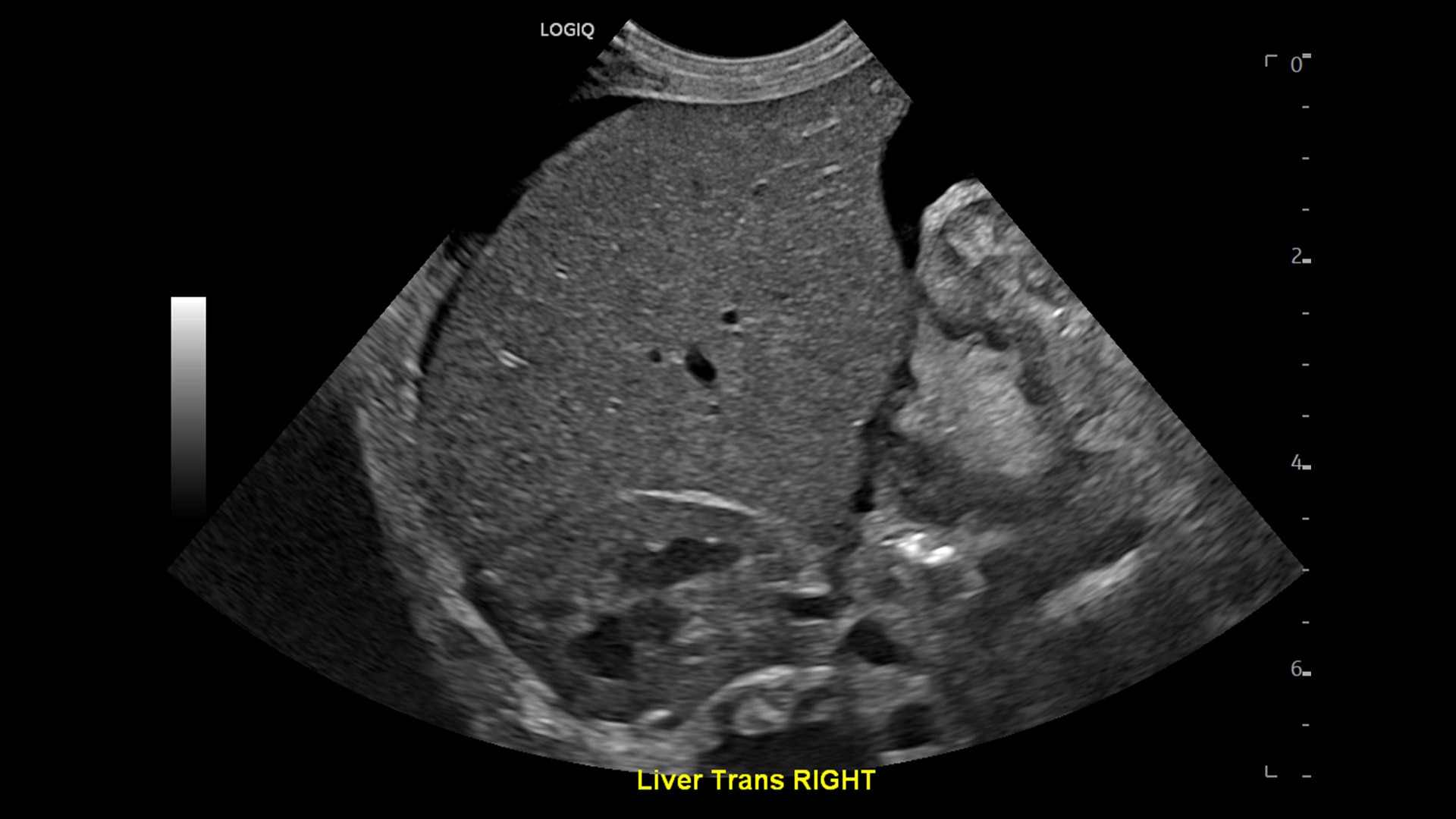 Product Media Carousel Image