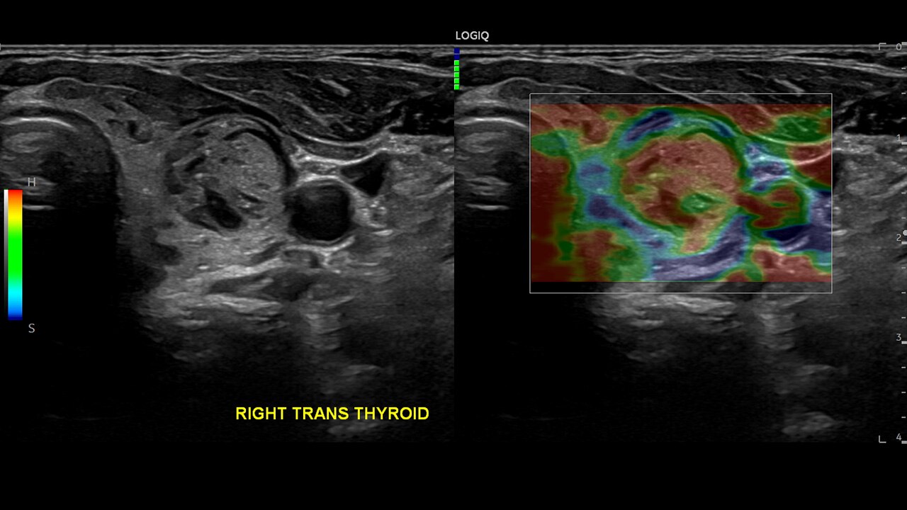Product Media Carousel Image